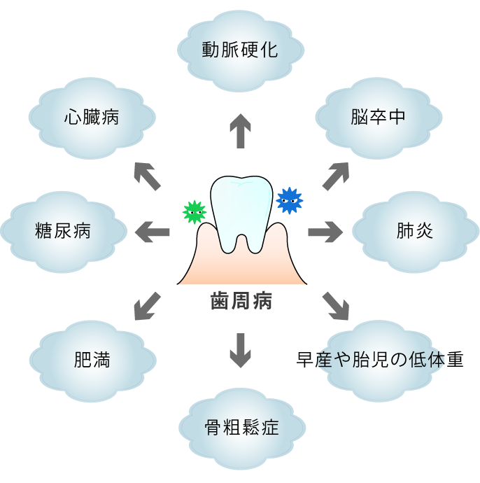 歯周病が引き起こす身体全体の影響
